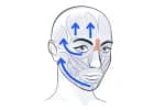 TecnoLift Facial: Abordaje Kinésico