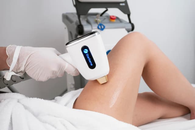 Depilación definitiva